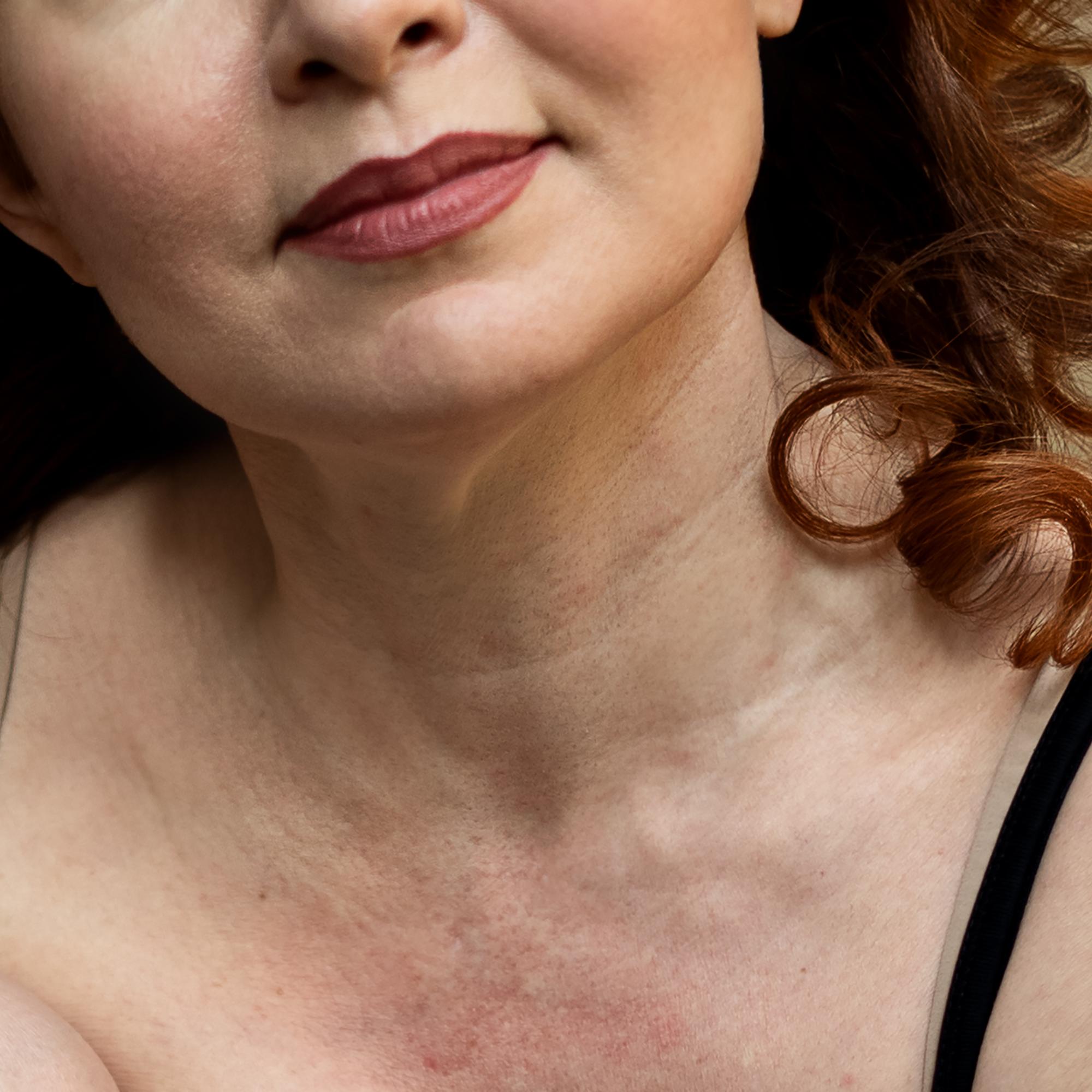 Testasimme somessa hehkutetun tuotteen, joka lupaa silottaa kaulan ihoa – näin 2 kuukauden testissä kävi 