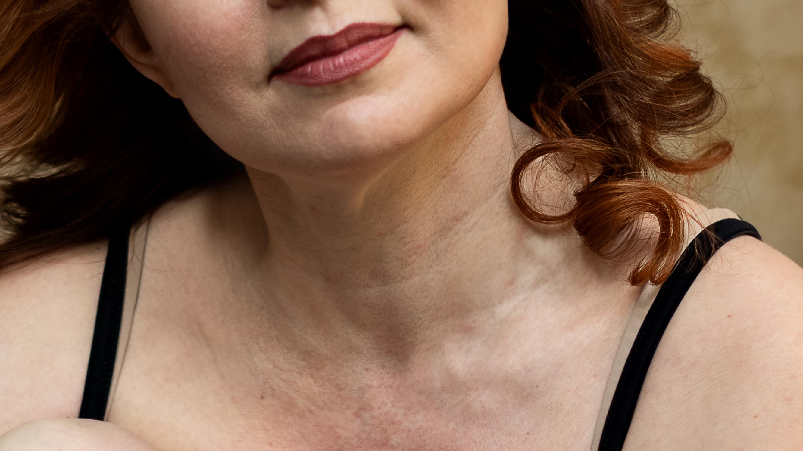 Testasimme somessa hehkutetun tuotteen, joka lupaa silottaa kaulan ihoa – näin 2 kuukauden testissä kävi 