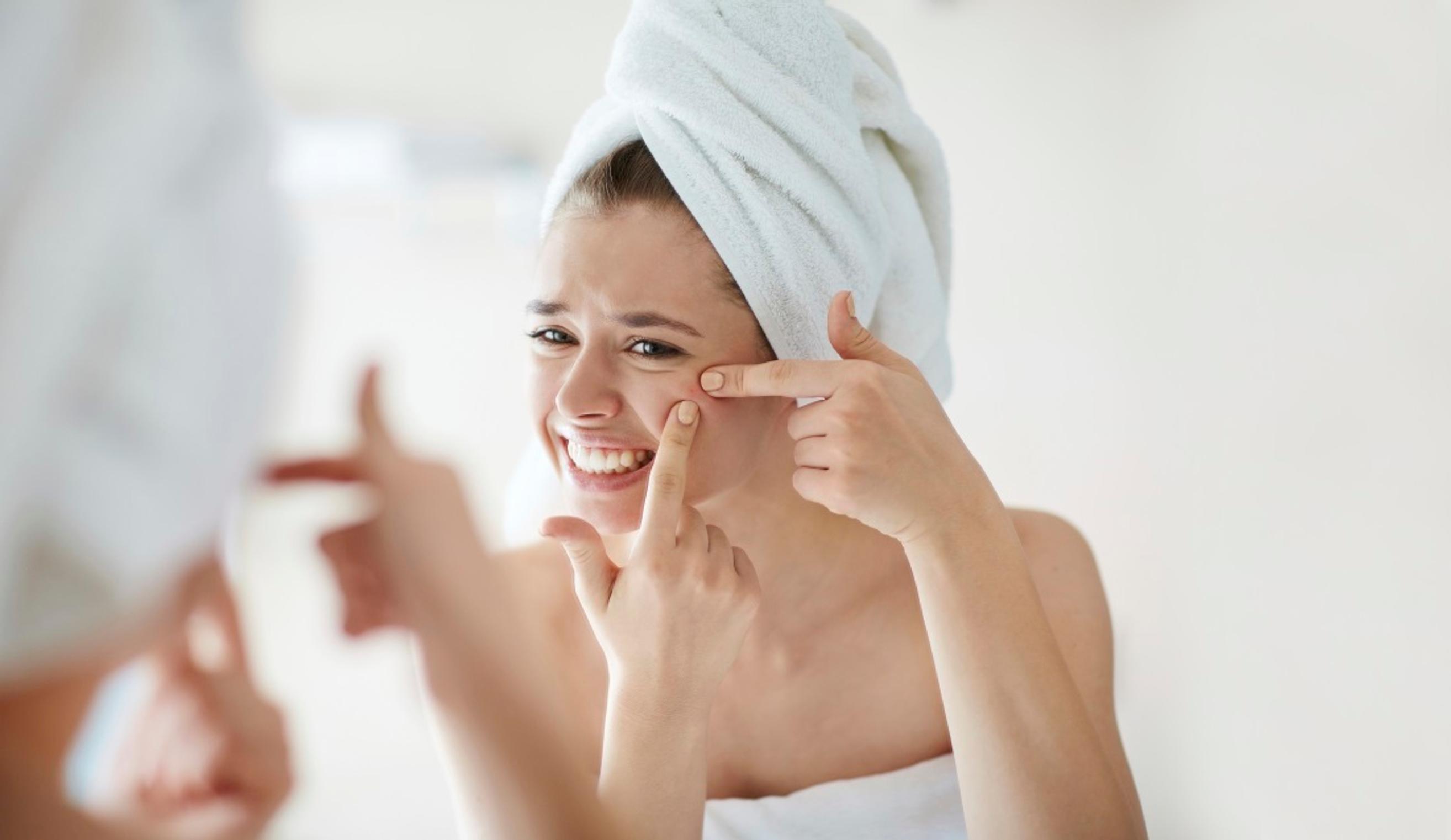 Pamahtiko poskeen mustapää vai papula? Tunnista eri näppytyypit kuvista!