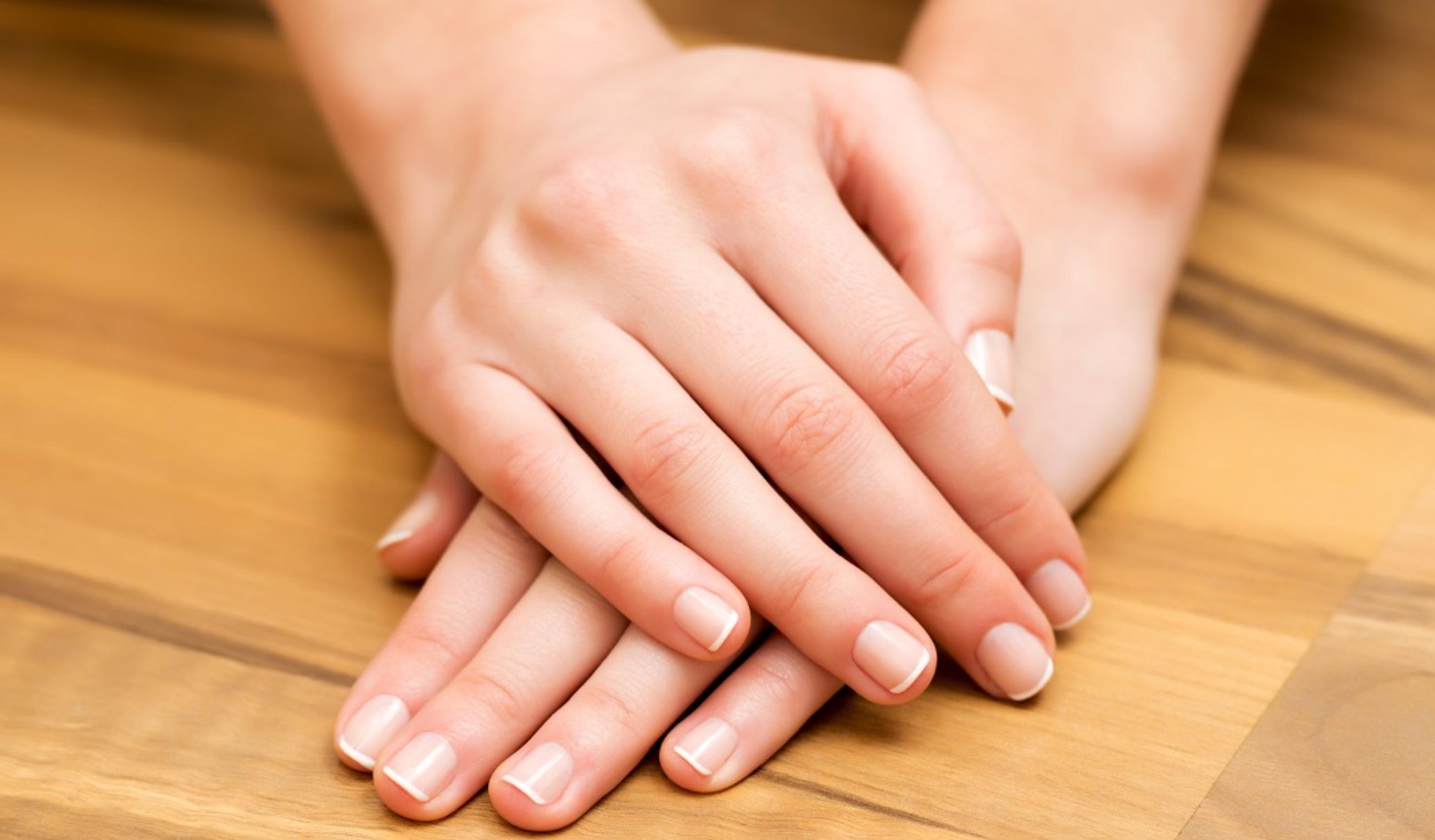 Ongelmakynsien hoito-opas