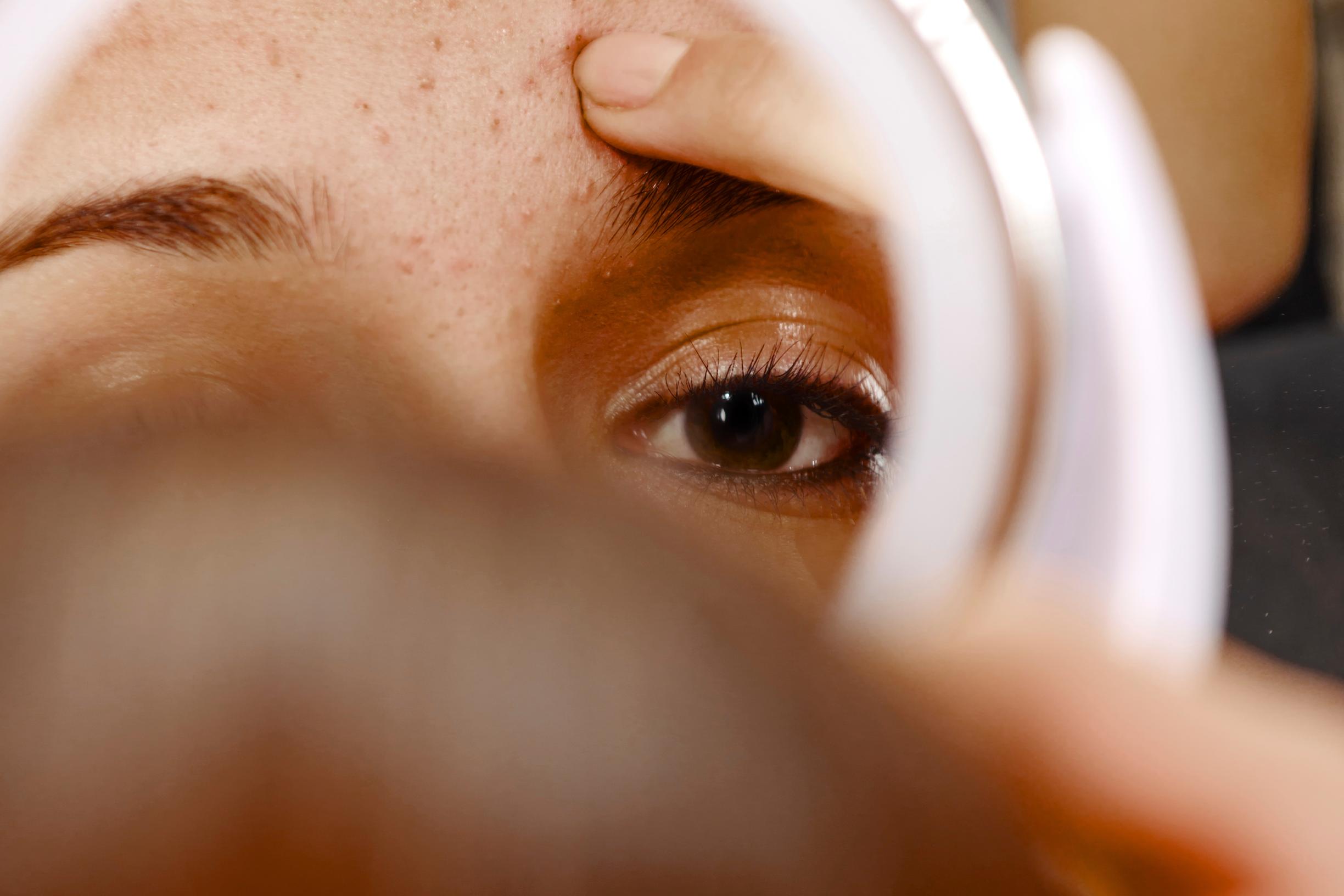 Mustapäitä voi ehkäistä 10 tavalla, joista kolme liittyy yllättäen hiustenhoitoon 