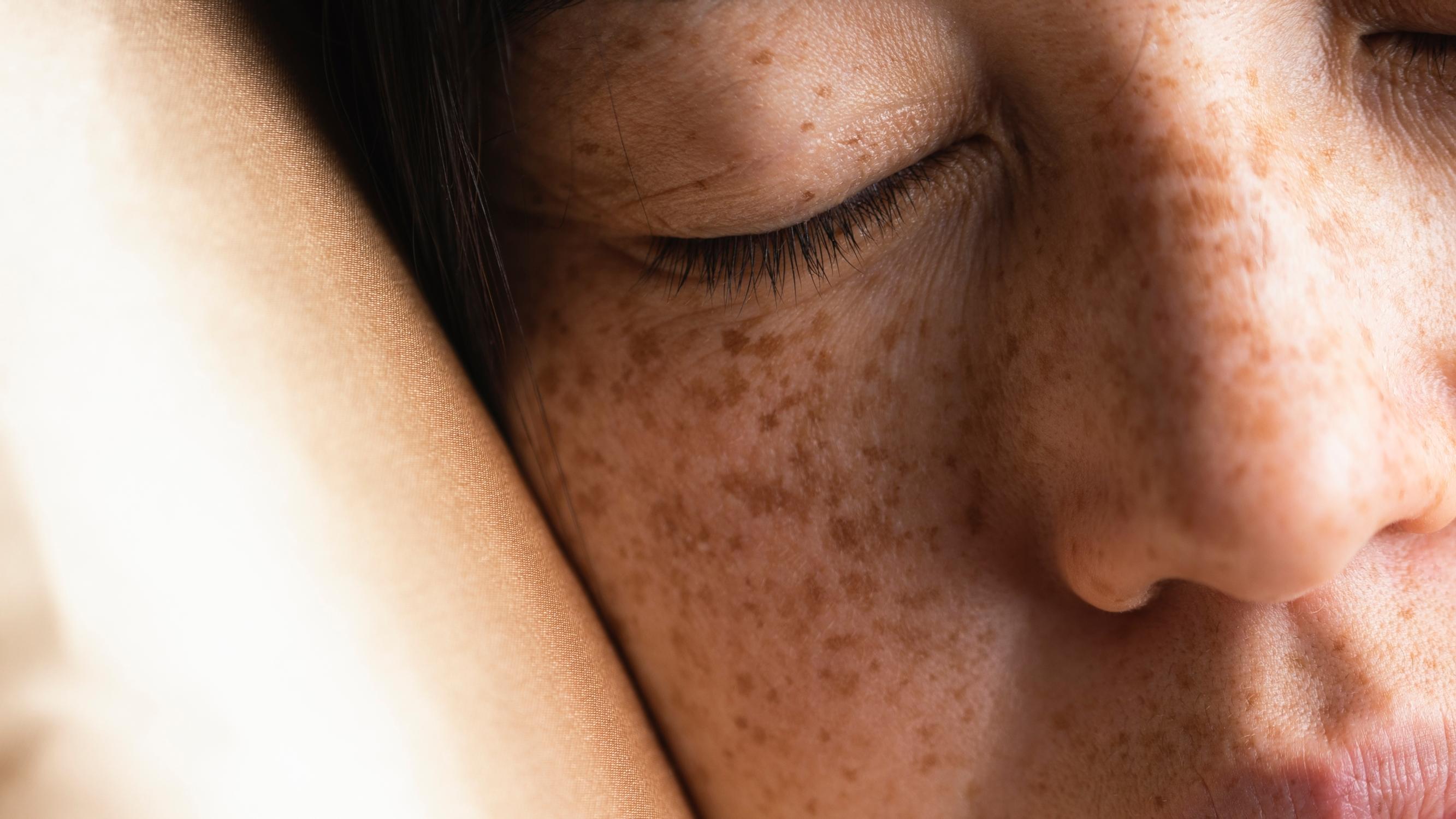 Parantaako silkkityynyliina hiusten tai ihon kuntoa? Asiantuntijat kertovat totuuden