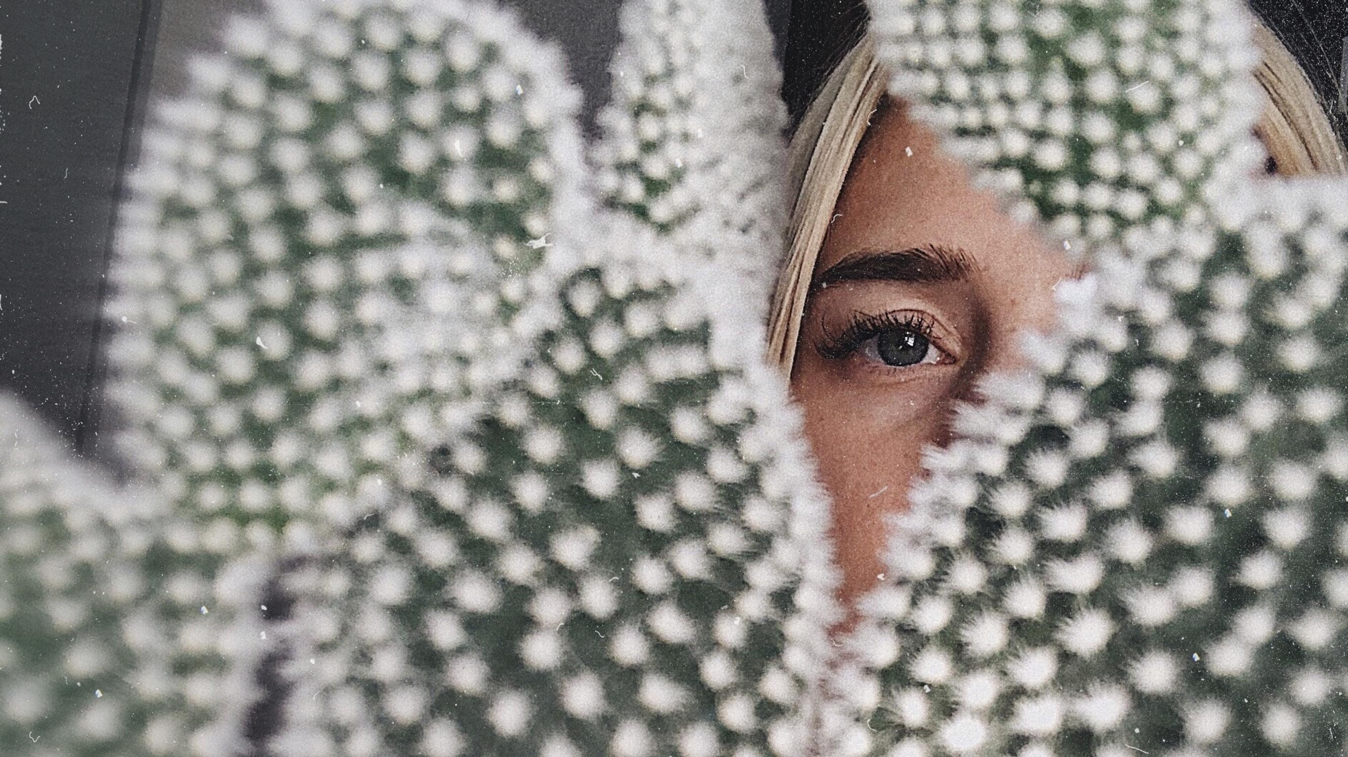 Sairastitko lapsena vesirokon? Sinulla on suuri riski saada aikuisena tämä tauti 