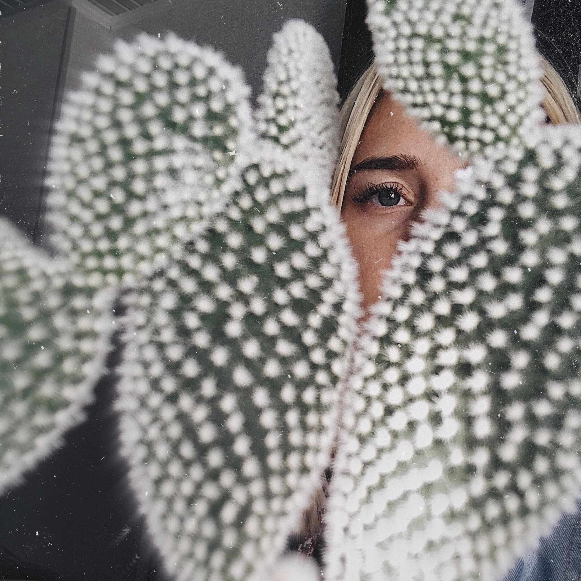 Sairastitko lapsena vesirokon? Sinulla on suuri riski saada aikuisena tämä tauti 