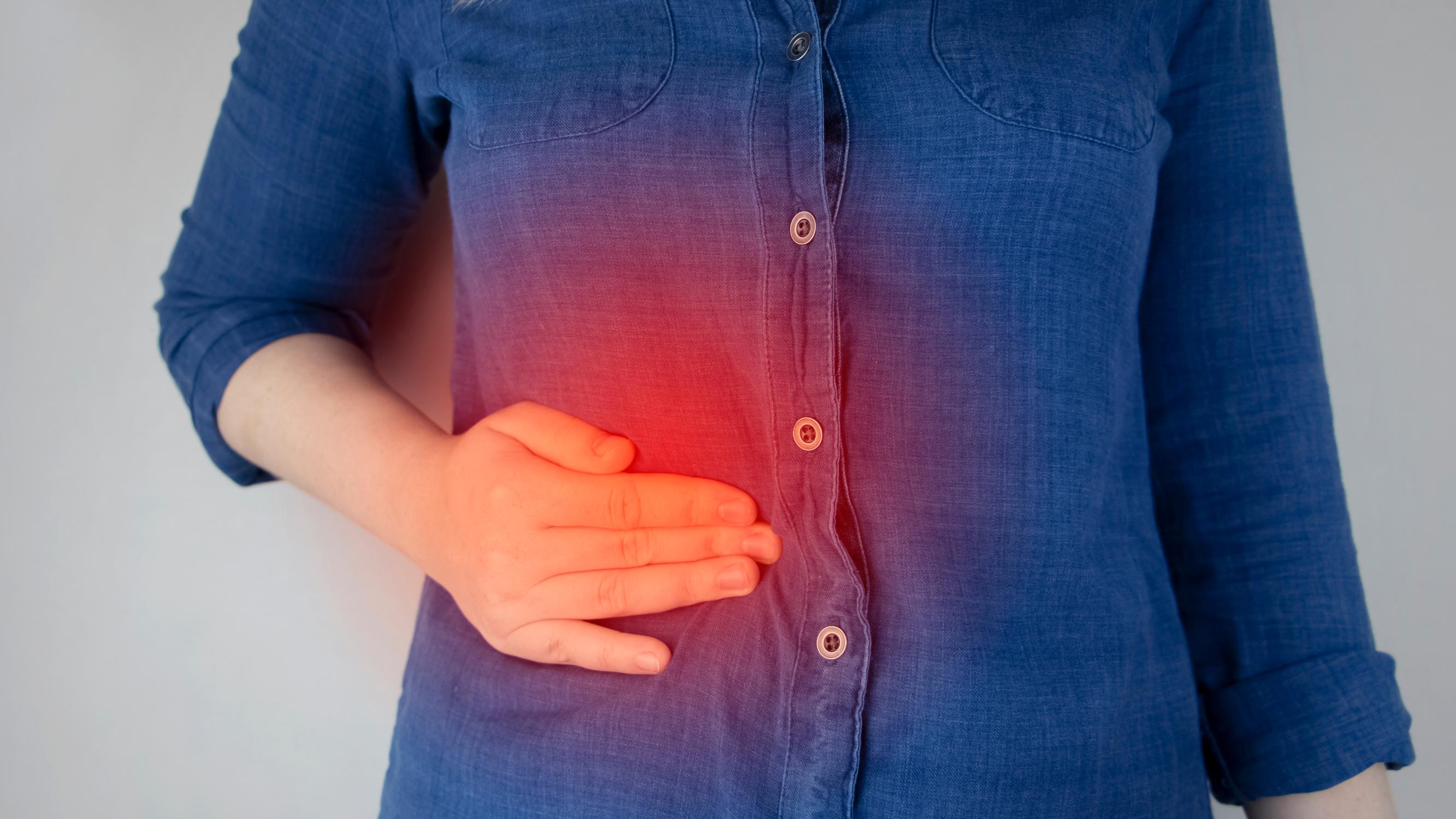 Sappikivitauti on yleisin keski-ikäisillä naisilla - mistä sappikivikohtauksen tunnistaa?