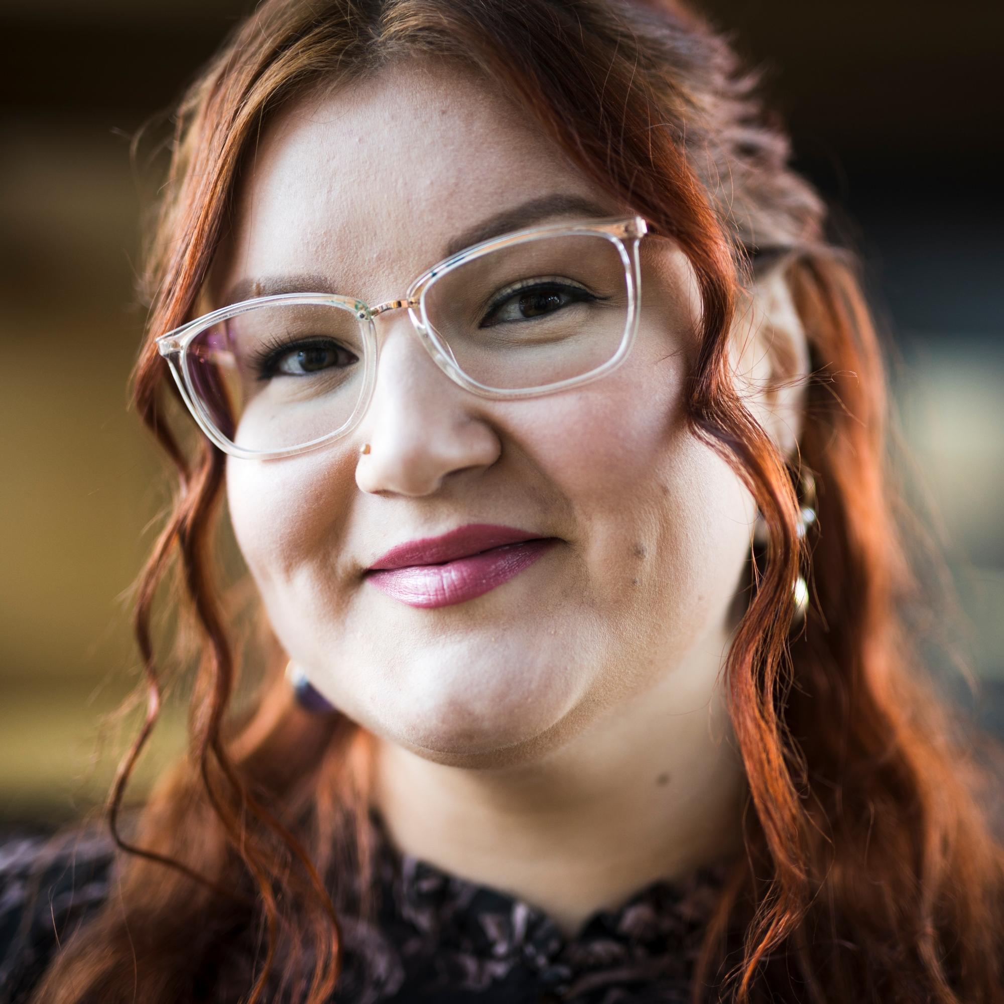 Camilla, 33, kärsii trikotillomaniasta: ”Kun menen peilin eteen, mietin, miksi teen itselleni näin”