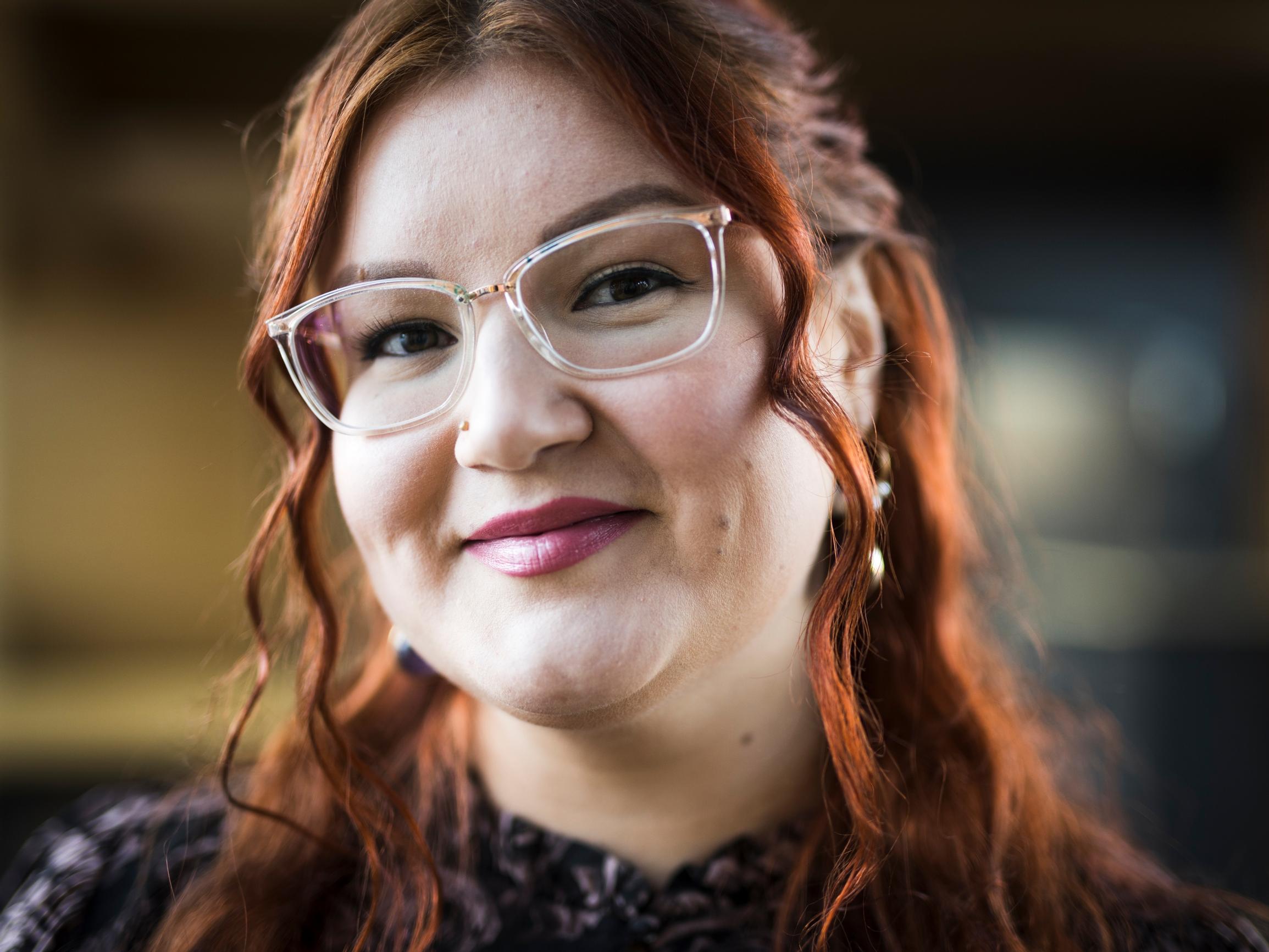 Camilla, 33, kärsii trikotillomaniasta: ”Kun menen peilin eteen, mietin, miksi teen itselleni näin”