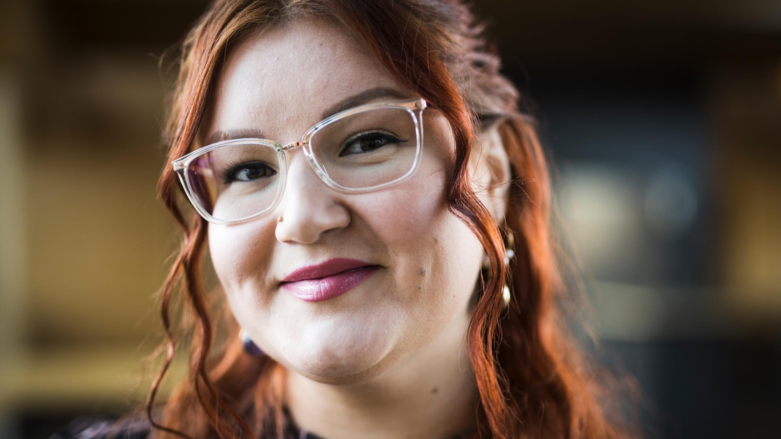 Camilla, 33, kärsii trikotillomaniasta: ”Kun menen peilin eteen, mietin, miksi teen itselleni näin”