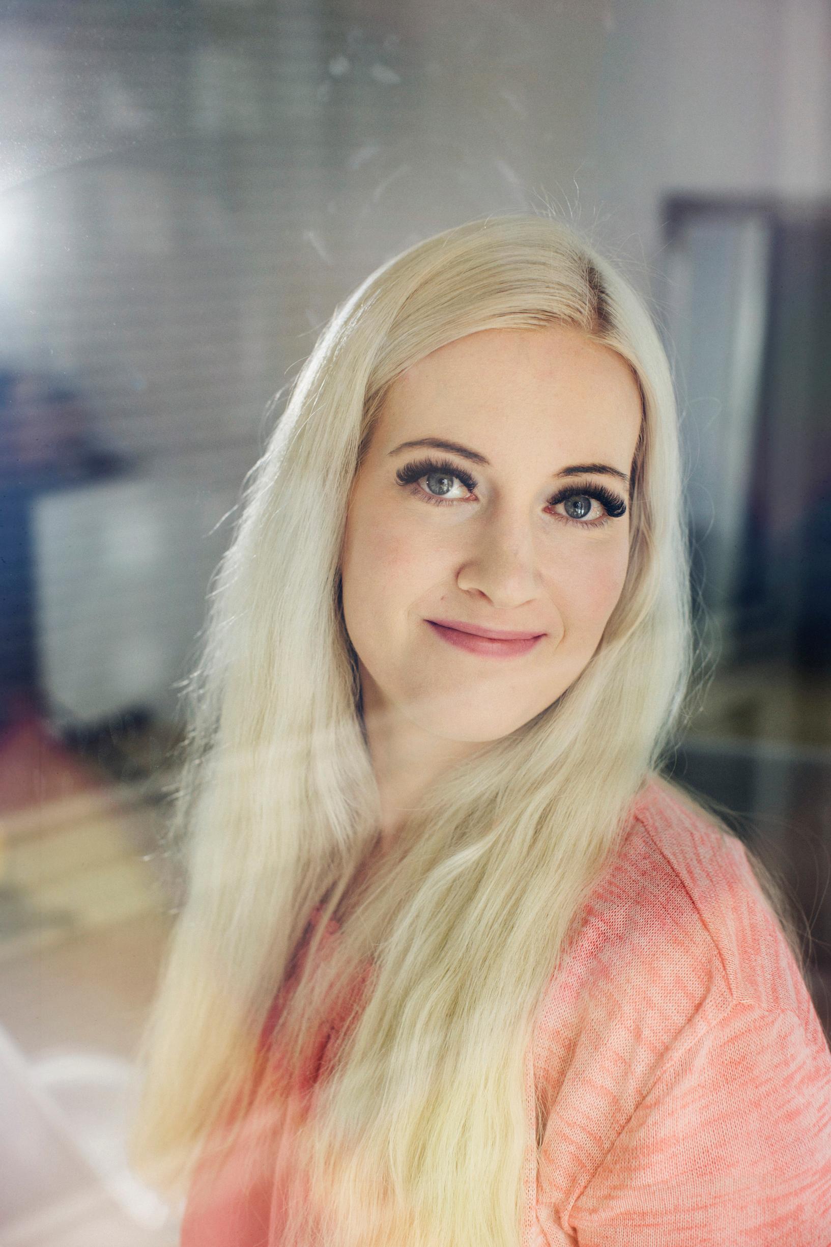 Yasmina kärsi vuosia kipeistä ja muhkuraisista jaloista ennen kuin sai diagnoosin: "En ole käynyt rannalla aikuisena"