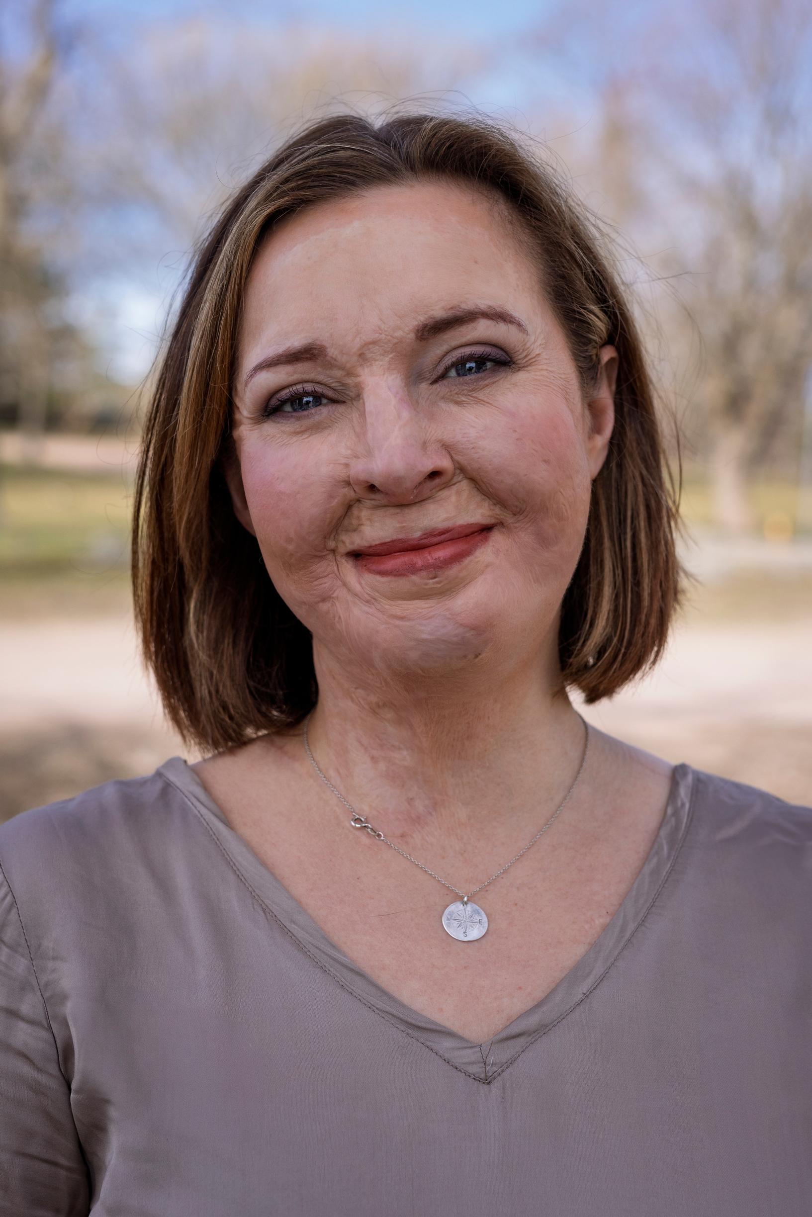 Onnettomuus opetti Ulrikalle, että yksin ei voi olla resilientti. Kasvu tapahtuu ihmissuhteissa ja suhteessa toisiin. On oleellista pyytää apua ja ottaa sitä myös vastaan.