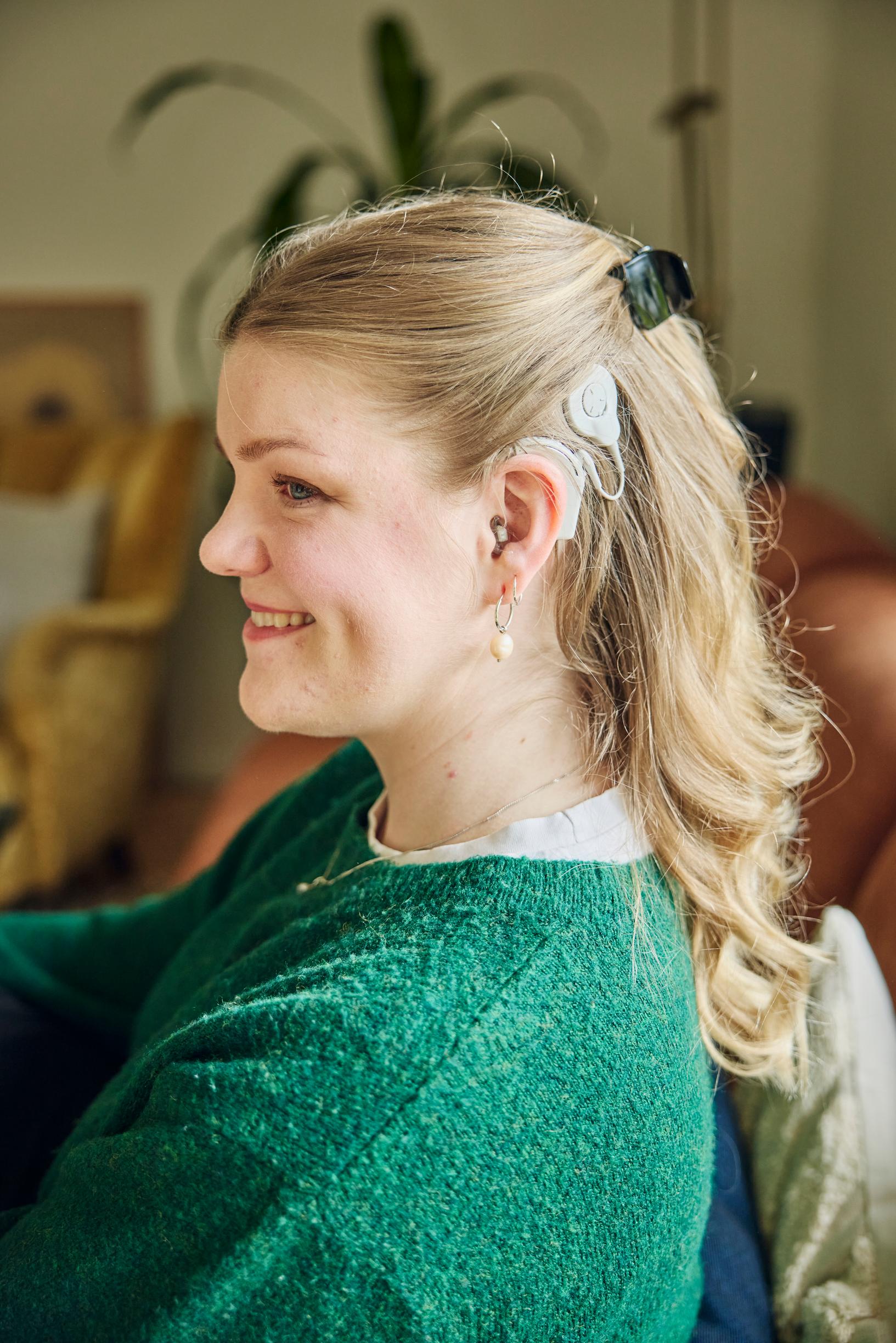 Helsinkiläinen Susanna Kivinen on nykyisin ylpeästi huonokuuloinen, sillä se on tuonut hänen elämäänsä paljon hyvää, kuten uusia ystäviä.