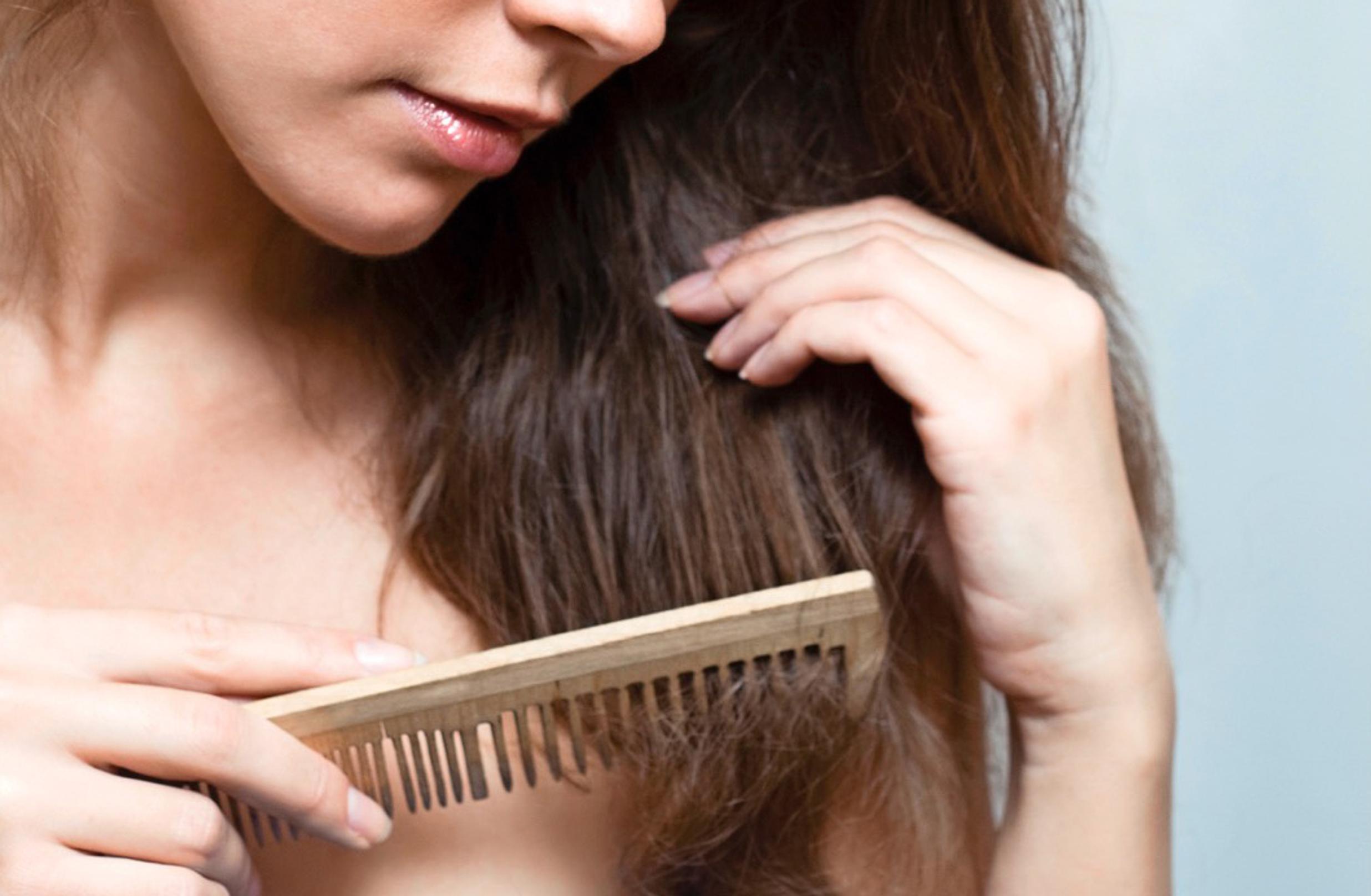 Mikä avuksi, kun hiukset ohenevat ja päänahka paistaa?