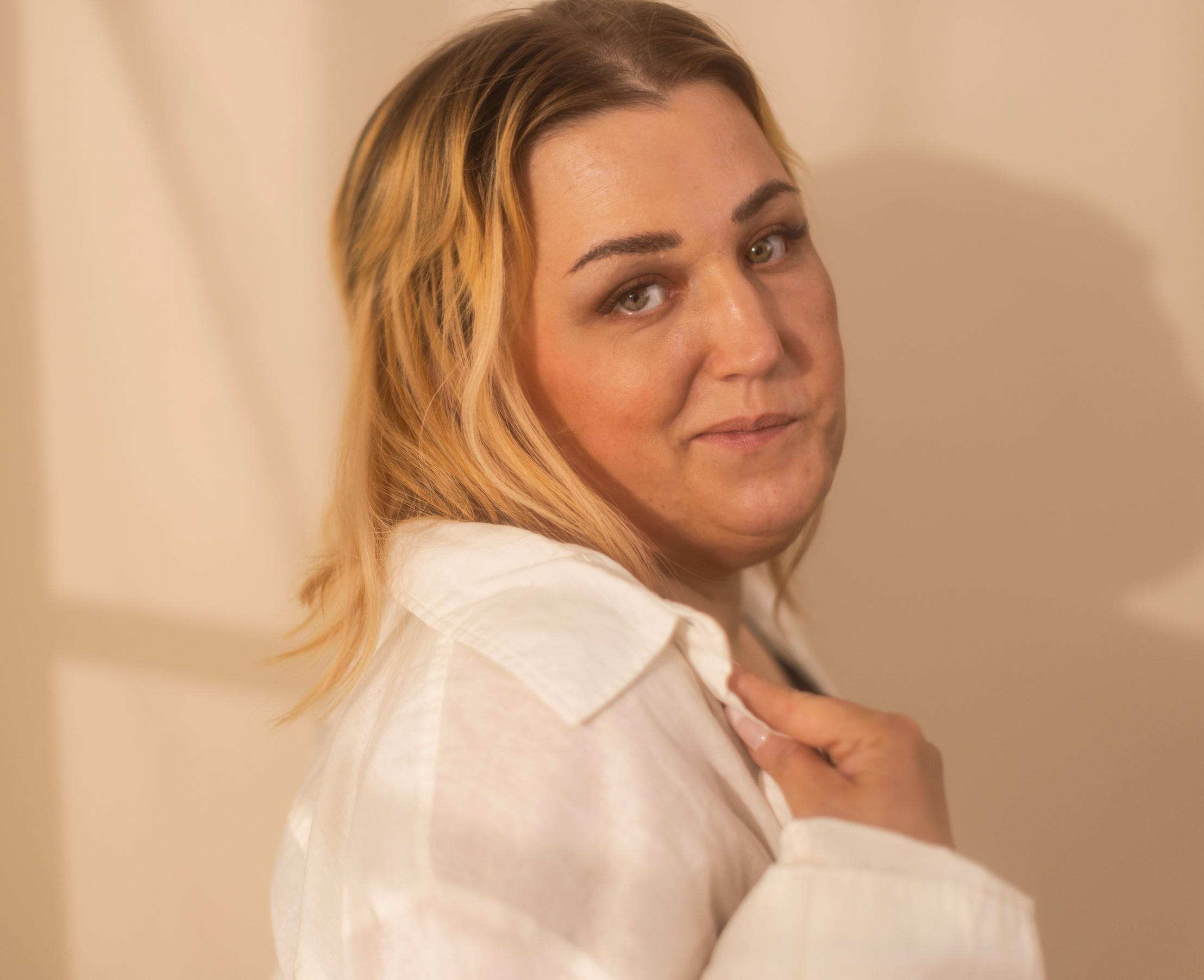 Tuntematon nainen tuijotti Annaa, 38, kaupassa niin pitkään, että törmäsi hyllyyn: ”En piilottele itseäni sen vuoksi, että muilla on ongelmia kasvojeni suhteen”