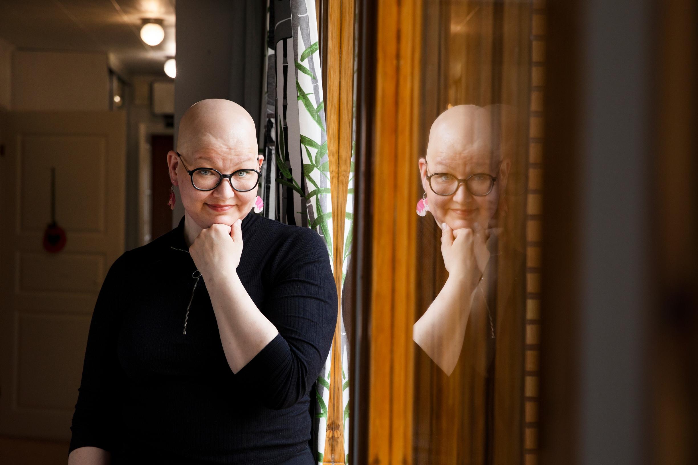 13-vuotiaana hiuksensa menettänyt Taru: ”En enää selittele alopeciaa, koska miksi pitäisi?”