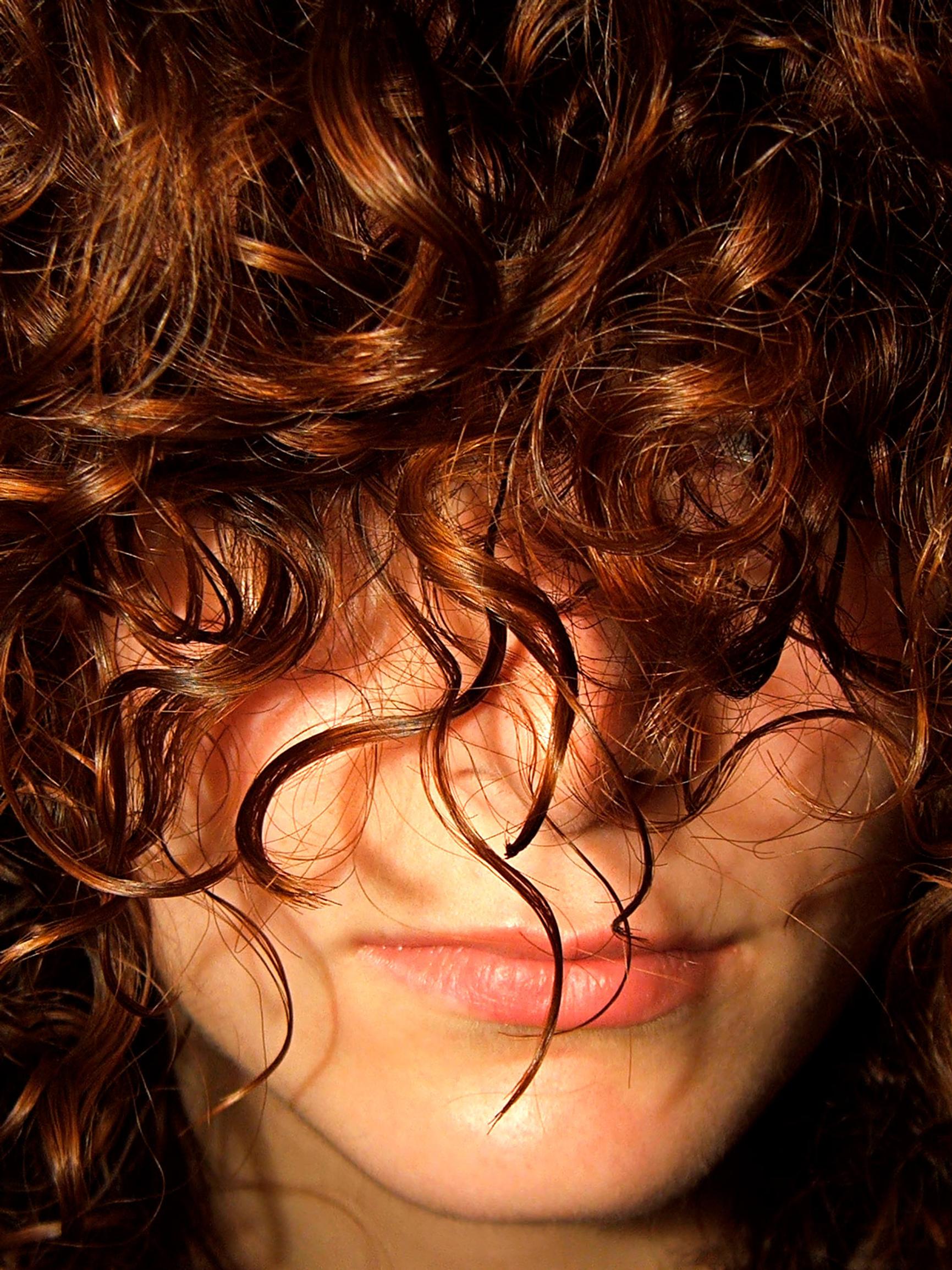 Punoittaako iho? Ihotautilääkäri kertoo, mitkä keinot ja hoidot auttavat