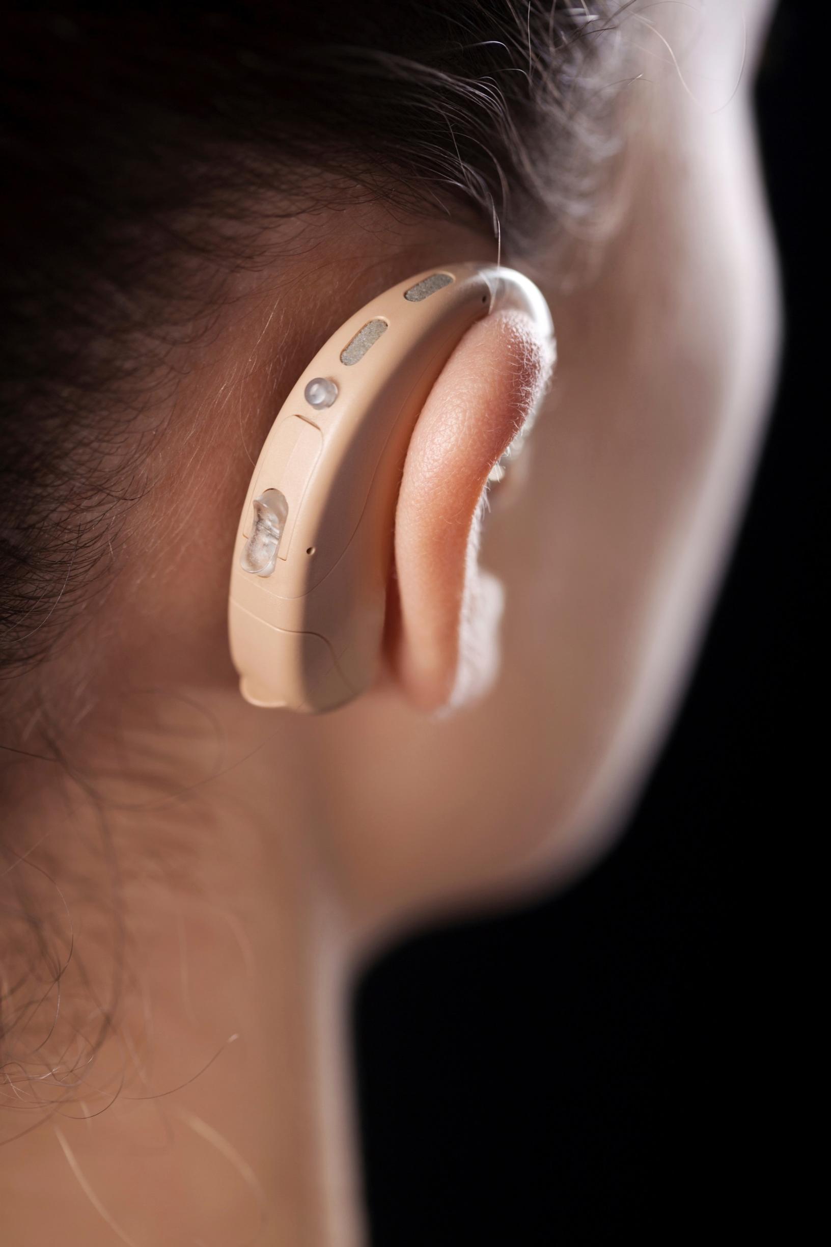 Kuuletko linnunlaulun? Milloin on syytä tutkituttaa kuulo?