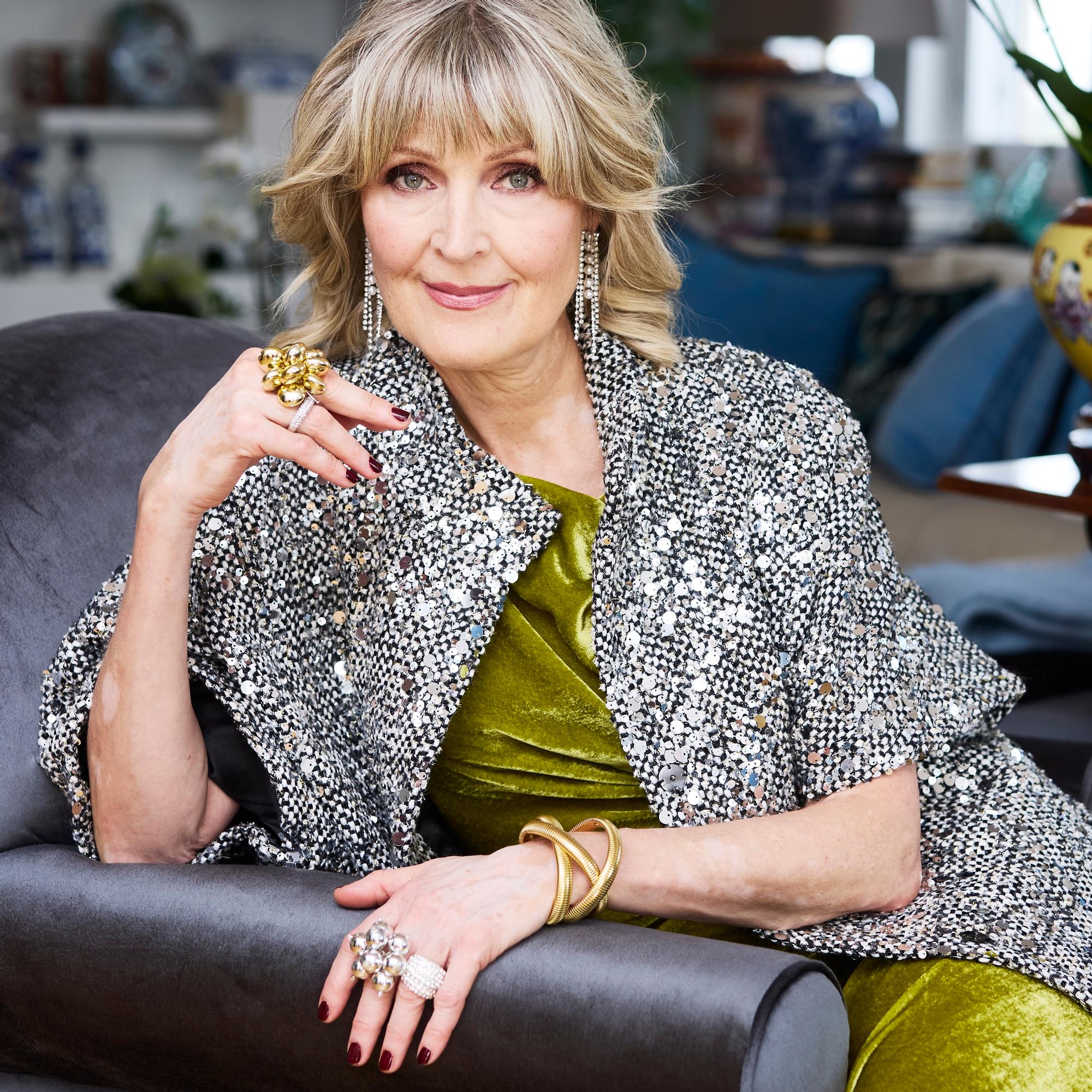 Neule sopii nyt hienosti bilevaatteeksi – 5 kekseliästä tyyliä loppuvuoden juhliin