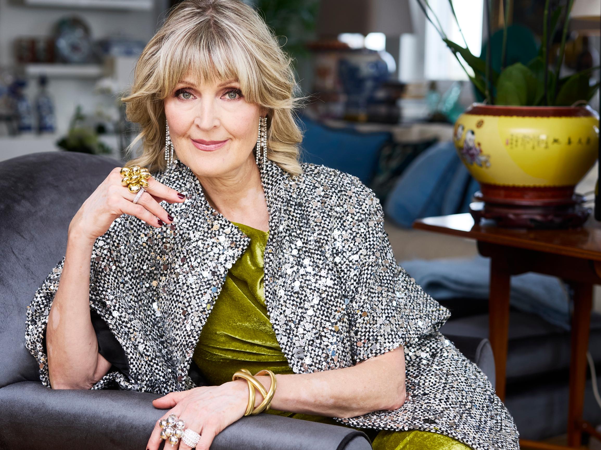 Neule sopii nyt hienosti bilevaatteeksi – 5 kekseliästä tyyliä loppuvuoden juhliin