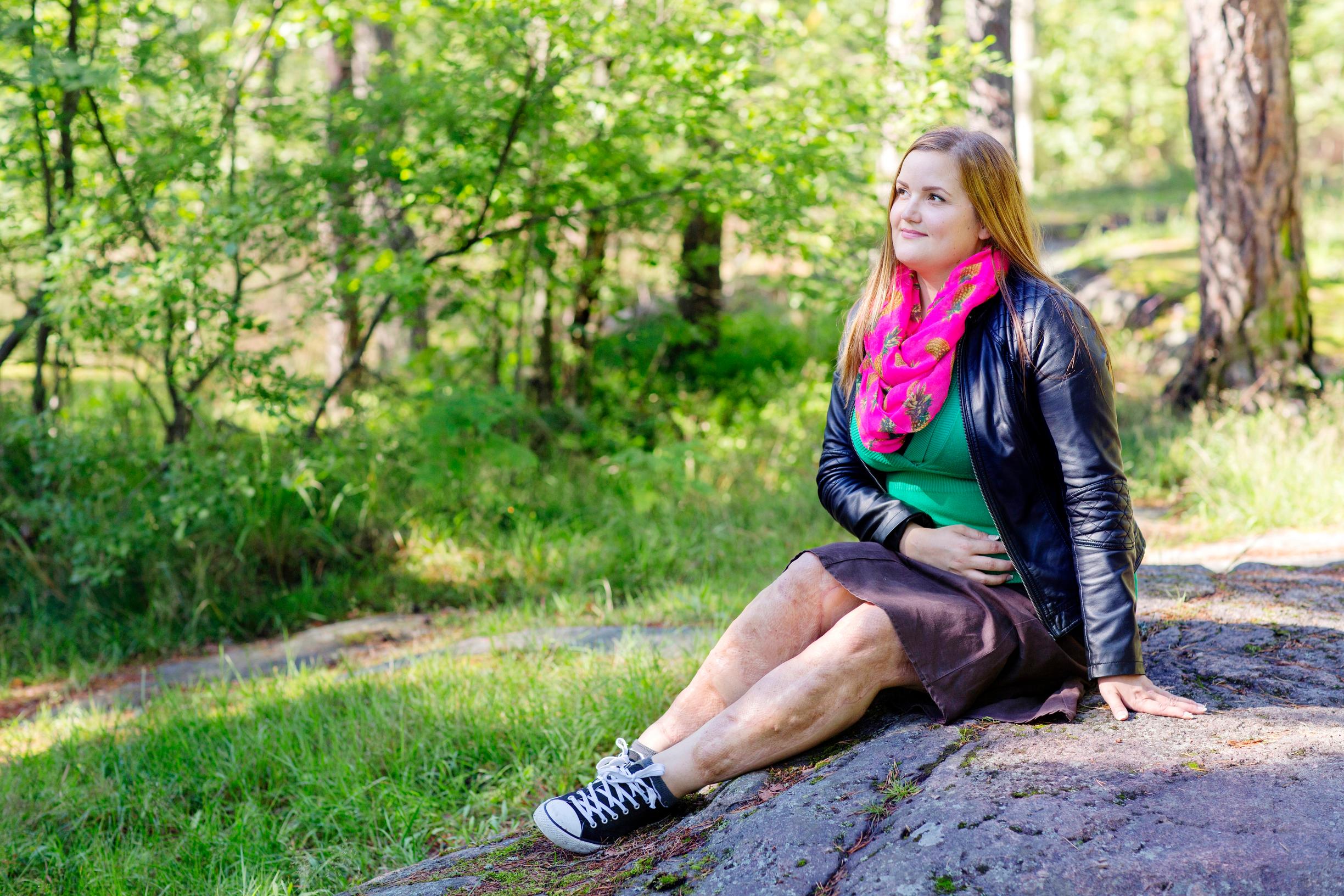 Katja on joutunut tottumaan tuijotukseen: ”Jalkojeni iho mustui ja kuoli”