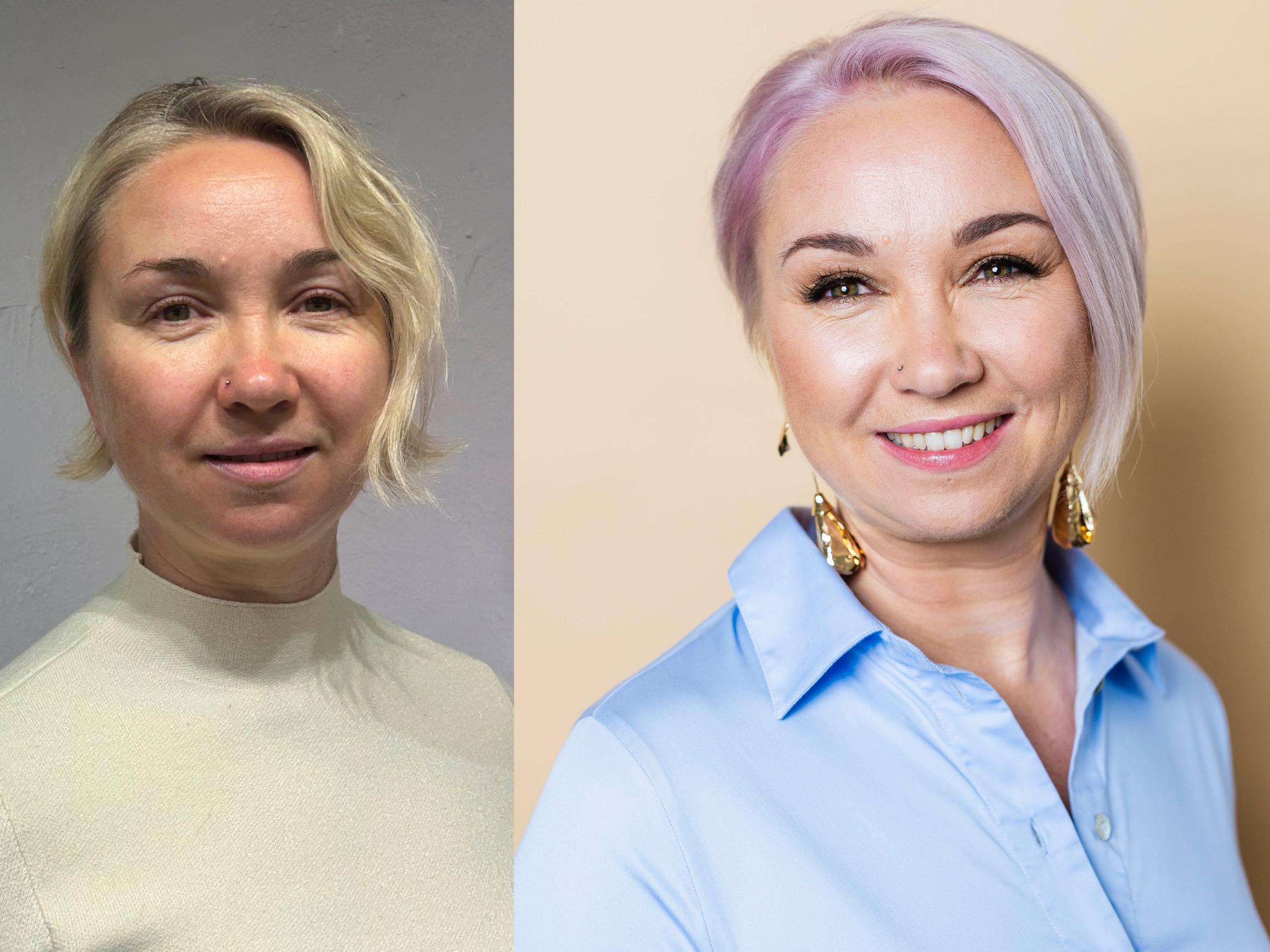 Riikka-Liisan, 44, hiukset alkoivat ohentua viisi vuotta sitten – muuttumisleikissä hennot hiukset saivat lisää tuuheutta ja upean uuden värin