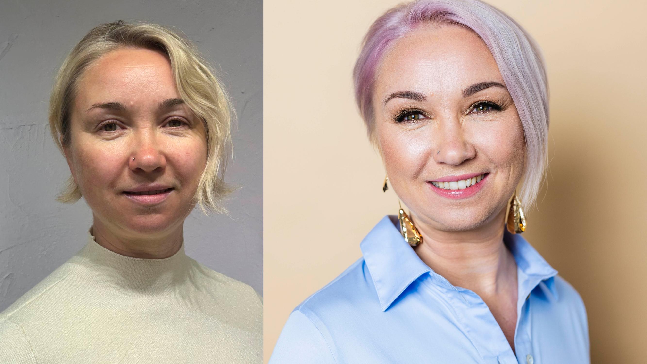 Riikka-Liisan, 44, hiukset alkoivat ohentua viisi vuotta sitten – muuttumisleikissä hennot hiukset saivat lisää tuuheutta ja upean uuden värin