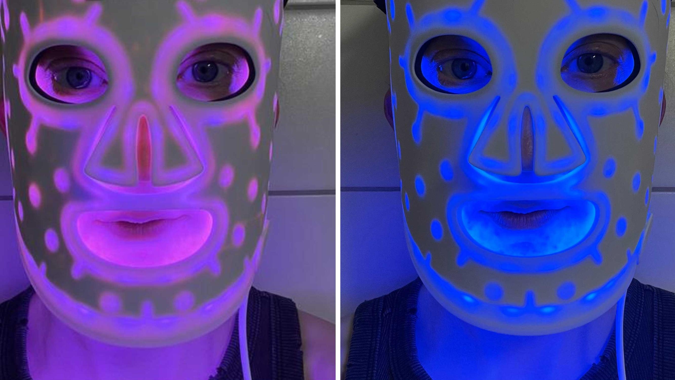 Vähemmän ryppyjä ja näppyjä? Outo valonaamio lupaa helpotusta iho-ongelmiin – testasimme, toimiiko se oikeasti