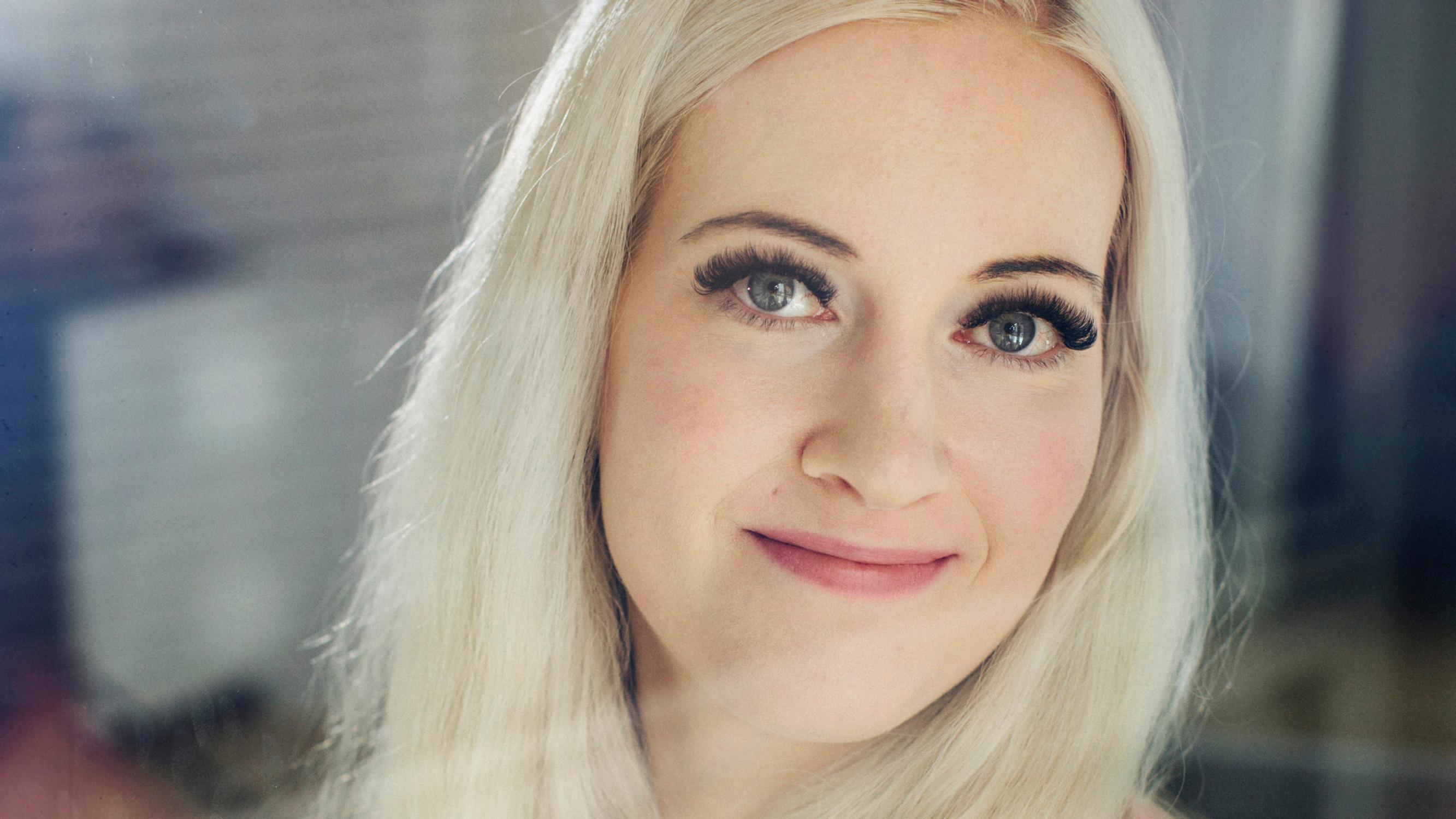 Yasmina kärsi vuosia kipeistä ja muhkuraisista jaloista ennen kuin sai diagnoosin: "En ole käynyt rannalla aikuisena"