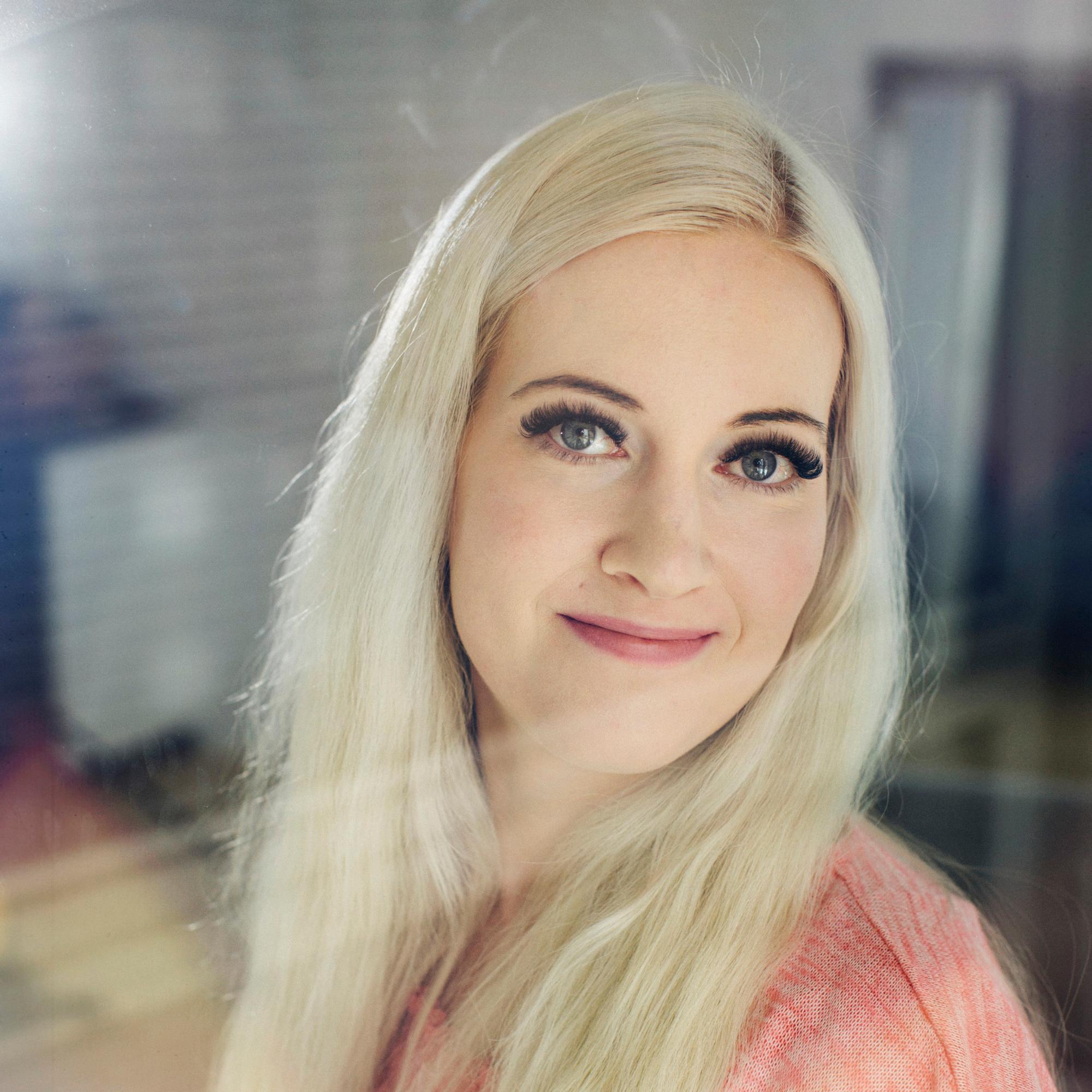 Yasmina kärsi vuosia kipeistä ja muhkuraisista jaloista ennen kuin sai diagnoosin: "En ole käynyt rannalla aikuisena"