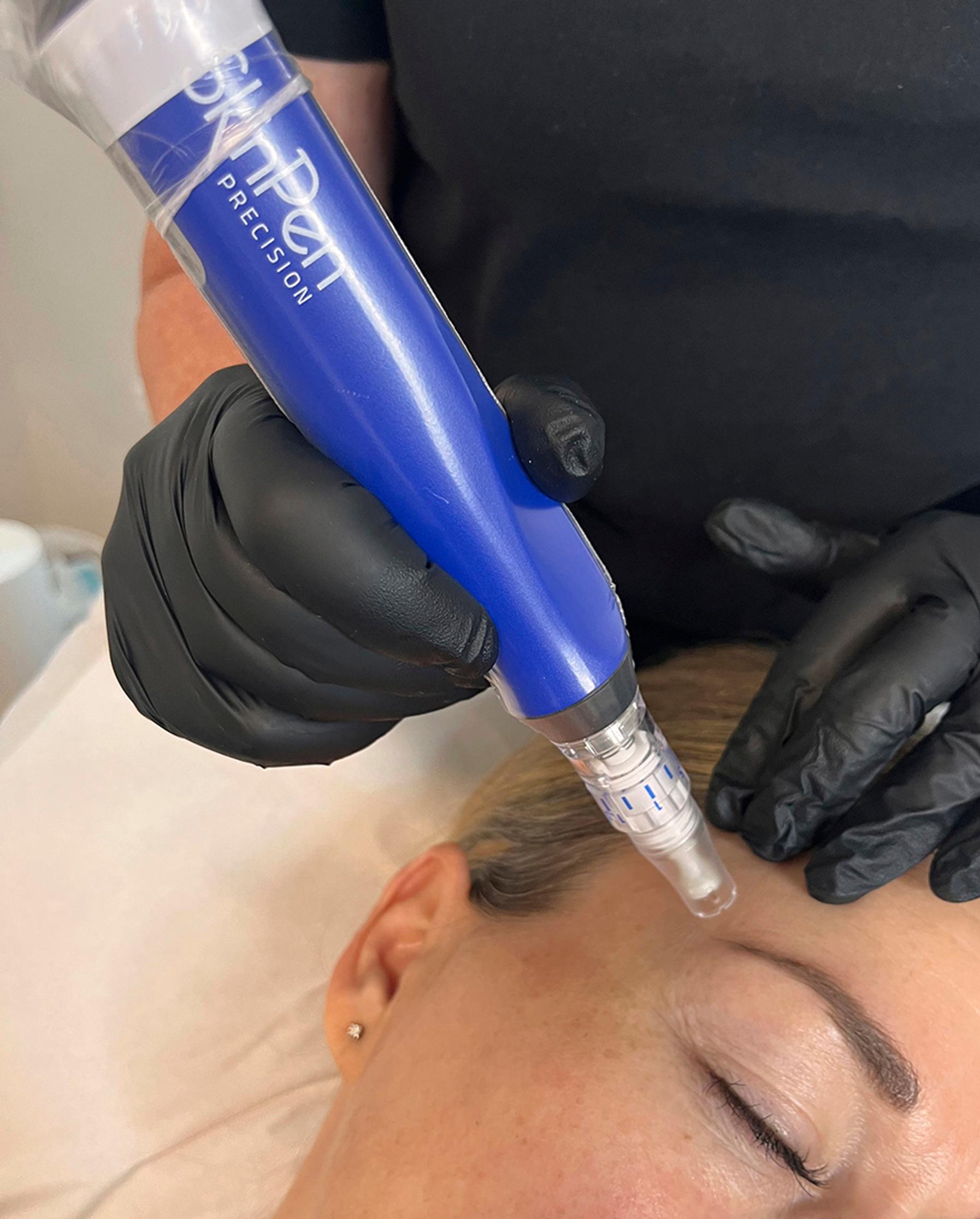 Skinpen