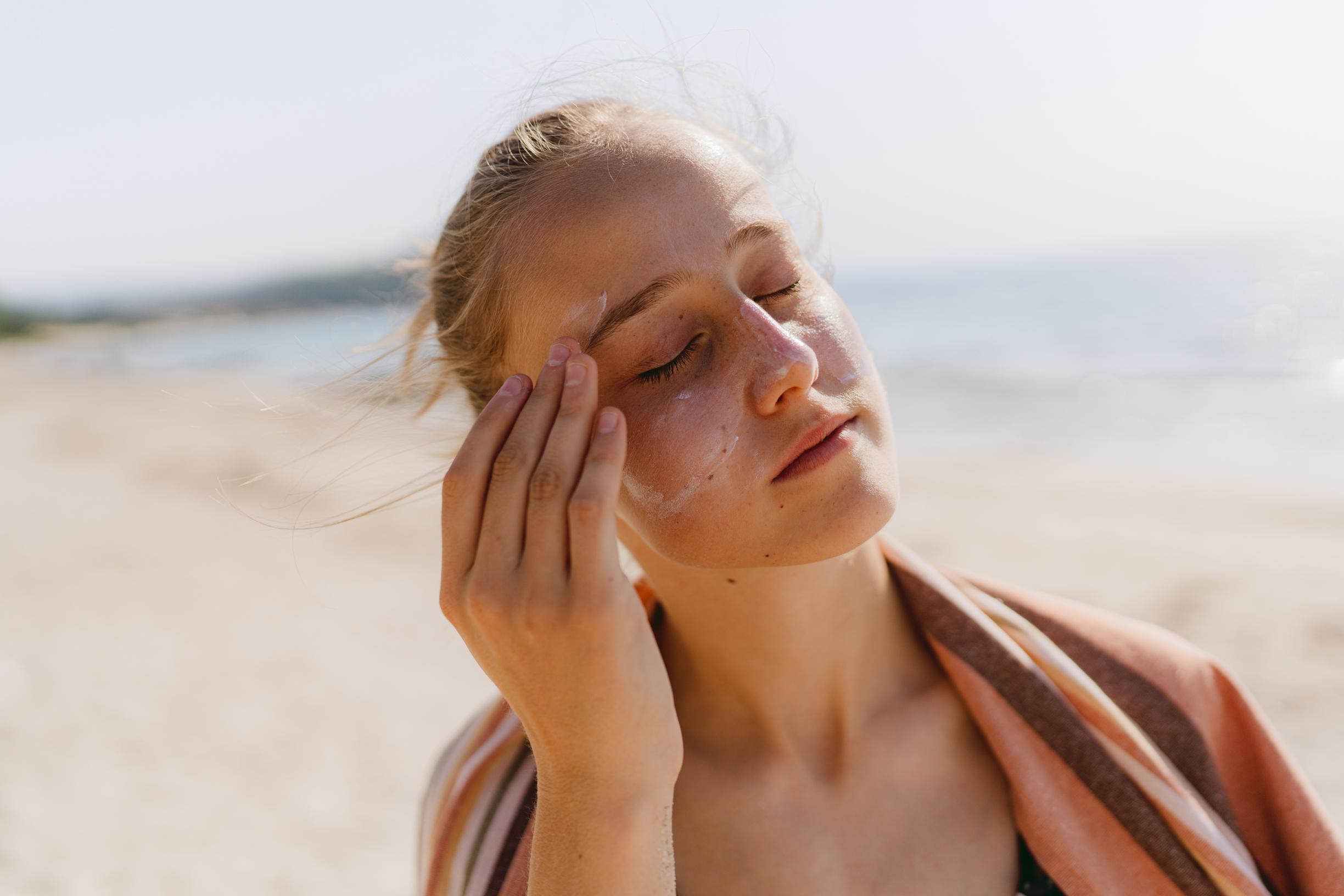 Aurinkoihottuma: oireet, esto ja hoito | eeva.fi