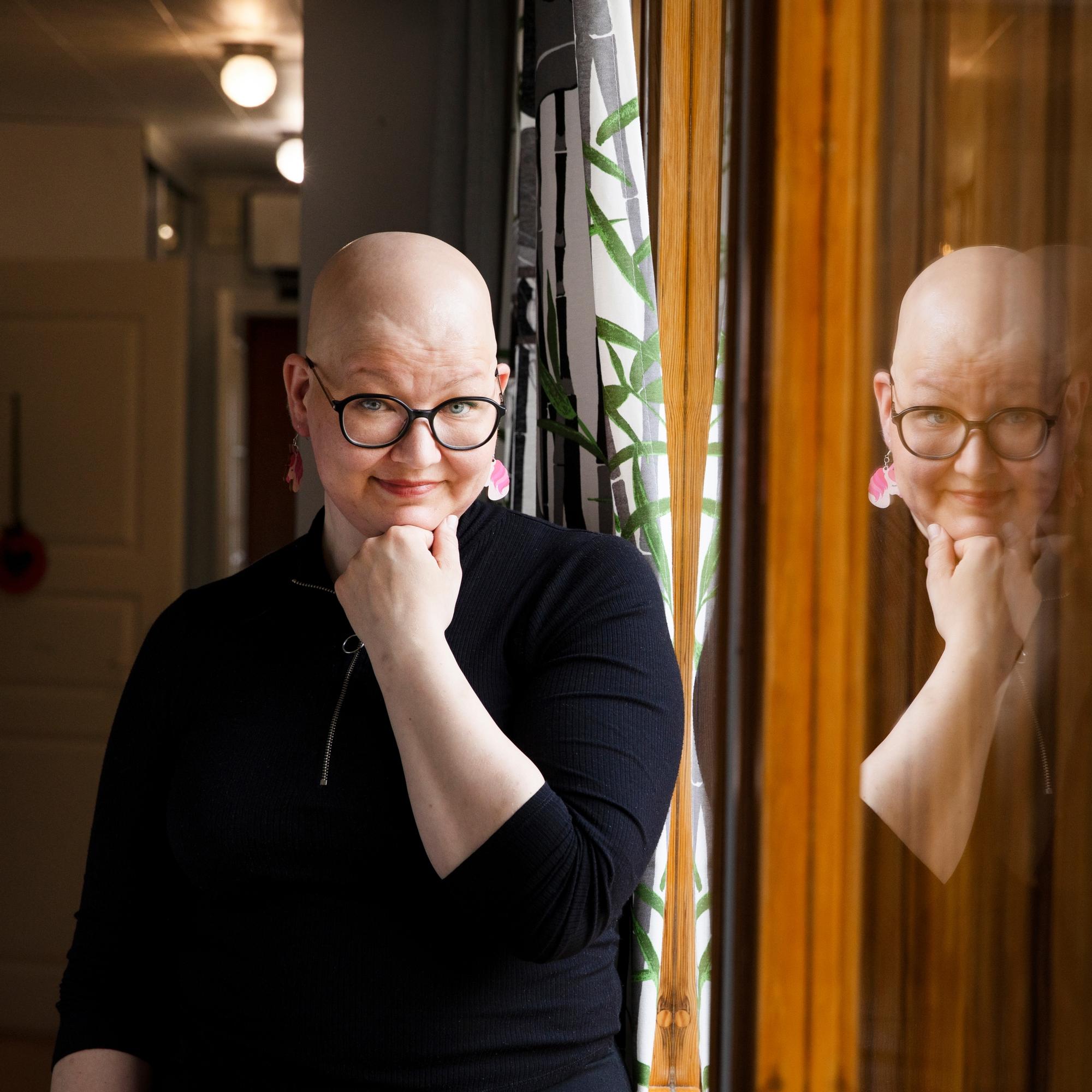 13-vuotiaana hiuksensa menettänyt Taru: ”En enää selittele alopeciaa, koska miksi pitäisi?”